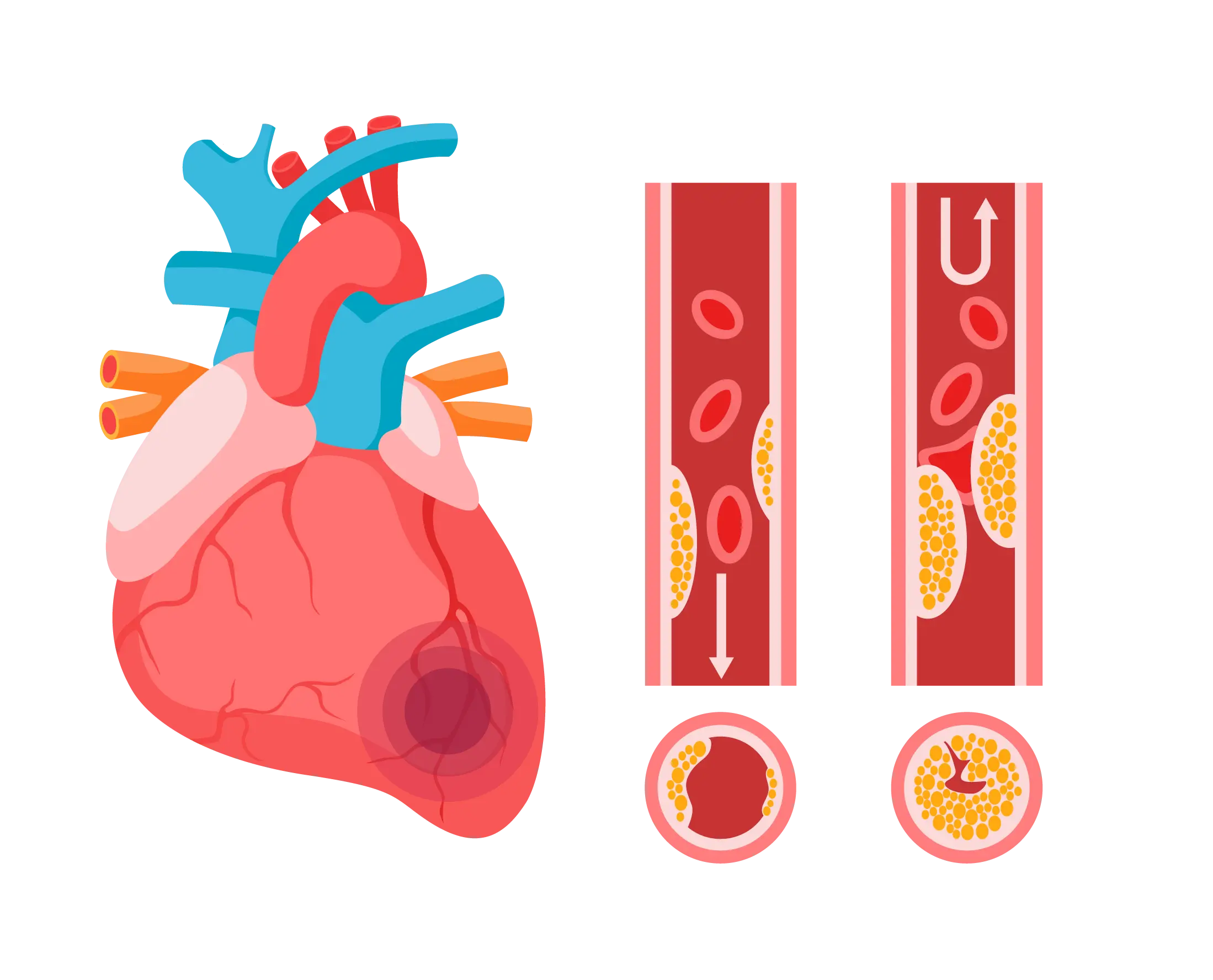 Congestive Heart Failure Home Care 